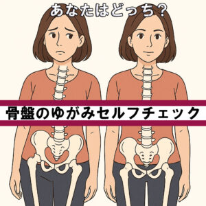 骨盤ゆがみセルフチェック方法ご紹介